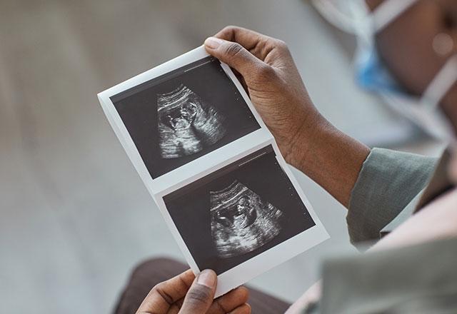 woman holds ultrasound picture